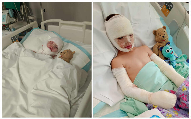 Tragiczny wypadek w Kazimierzu Biskupim – ojciec i 6-letni syn walczą o życie po wybuchu