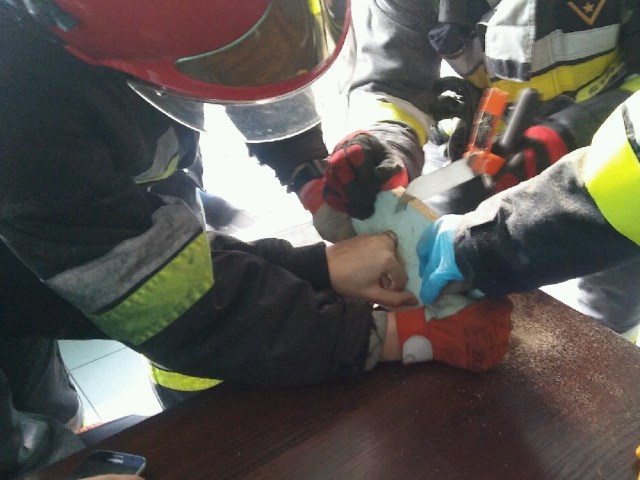 Strażacy uratowali palce